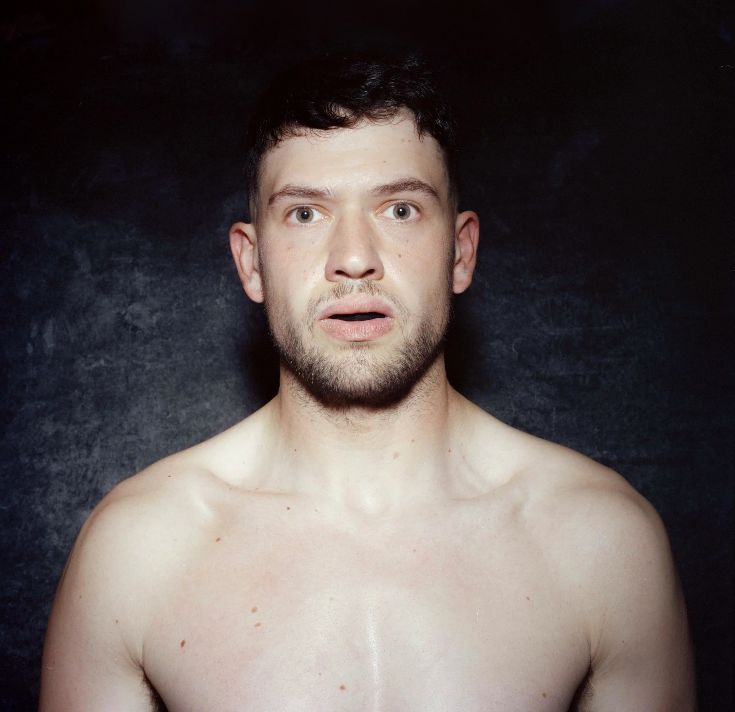 Post-fight portrait of a dark-haired fighter with mouth open and stunned wide eyes, marks on his cheekbones